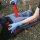 Slishman Traction Splint (STS) GEN. 2